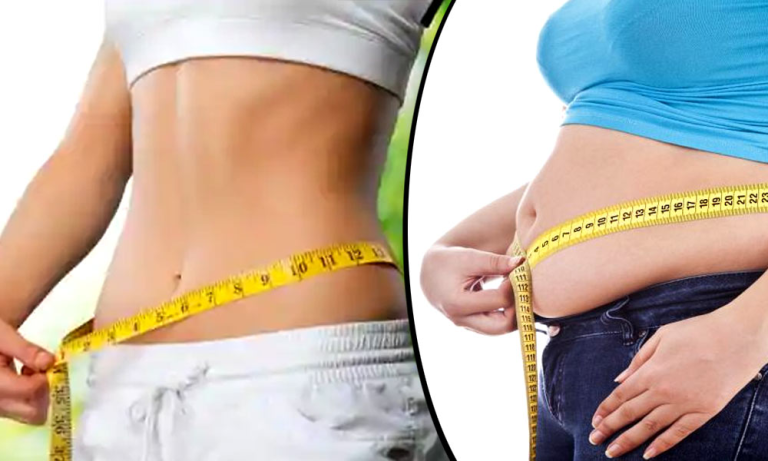 Wellbutrin Weight Loss